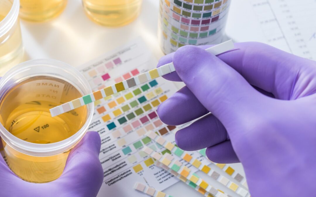35765n - sap 4/2000 w/nit (urine)